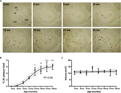 Microglia Express Insulin-Like Growth Factor-1 in the Hippocampus of Aged APPswe/PS1ΔE9 Transgenic Mice